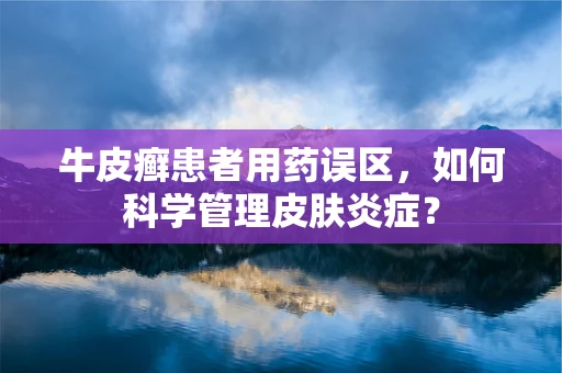 牛皮癣患者用药误区，如何科学管理皮肤炎症？