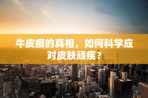 牛皮癣的真相，如何科学应对皮肤顽疾？