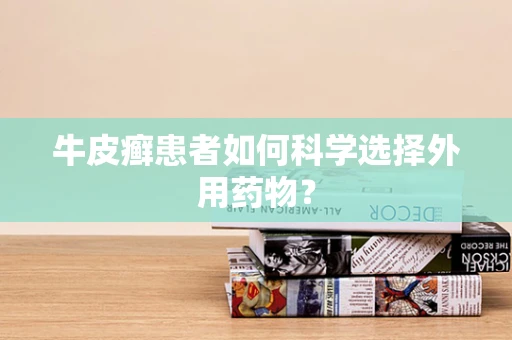牛皮癣患者如何科学选择外用药物？